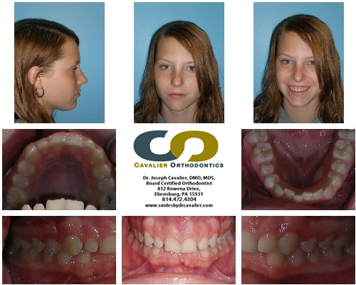 Orthodontist Ebensburg, PA