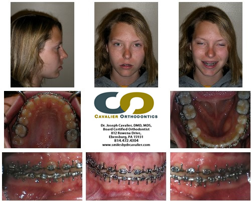 Orthodontist Ebensburg, PA